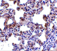 Anti-PEN2 antibody used in IHC (Paraffin sections) (IHC-P). GTX85063