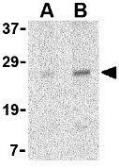 Anti-MD1 antibody used in Western Blot (WB). GTX85065