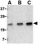 Anti-MD1 antibody used in Western Blot (WB). GTX85066