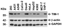 Anti-TIM-1 antibody used in Western Blot (WB). GTX85067