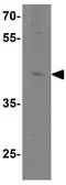 Anti-TIM-1 antibody used in Western Blot (WB). GTX85068