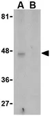 Anti-APOBEC3G antibody used in Western Blot (WB). GTX85084