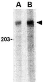 Anti-PARC antibody used in Western Blot (WB). GTX85085