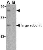 Anti-Caspase 14 antibody used in Western Blot (WB). GTX85087