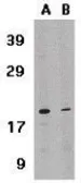 Anti-IL21 antibody used in Western Blot (WB). GTX85088
