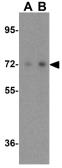 Anti-Raf1 antibody used in Western Blot (WB). GTX85101
