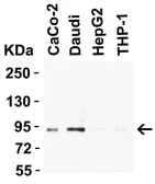 Anti-B-Raf antibody used in Western Blot (WB). GTX85102