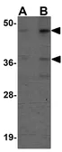 Anti-SIRT7 antibody used in Western Blot (WB). GTX85103