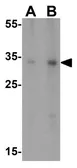 Anti-SIRT5 antibody used in Western Blot (WB). GTX85104