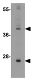 Anti-SIRT3 antibody used in Western Blot (WB). GTX85105