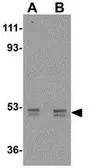 Anti-AP2M1 antibody used in Western Blot (WB). GTX85110