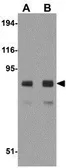 Anti-Albumin antibody used in Western Blot (WB). GTX85111