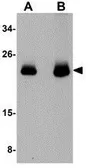 Anti-CDC42 antibody used in Western Blot (WB). GTX85114