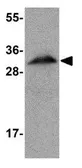 Anti-Apolipoprotein A1 antibody used in Western Blot (WB). GTX85115
