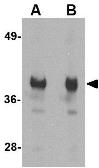 Anti-GAPDH antibody used in Western Blot (WB). GTX85118