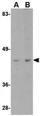 Anti-beta Actin antibody used in Western Blot (WB). GTX85119
