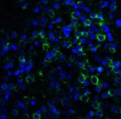 Anti-MD2 antibody [1A2E3] used in IHC (Paraffin sections) (IHC-P). GTX85121