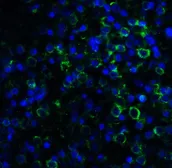 Anti-MD2 antibody [1A2E3] used in IHC (Paraffin sections) (IHC-P). GTX85121