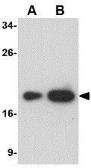 Anti-MD2 antibody [1A2E3] used in Western Blot (WB). GTX85121