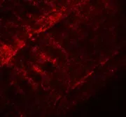 Anti-SYNPO2 antibody used in IHC (Paraffin sections) (IHC-P). GTX85139