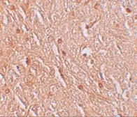 Anti-LMBRD1 antibody used in IHC (Paraffin sections) (IHC-P). GTX85141