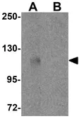 Anti-PIWIL3 antibody used in Western Blot (WB). GTX85145