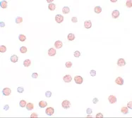 Anti-Pappalysin 2 antibody used in Immunocytochemistry/ Immunofluorescence (ICC/IF). GTX85150