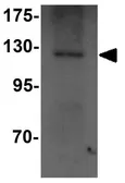 Anti-NALP14 antibody used in Western Blot (WB). GTX85152