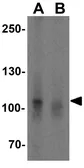Anti-NLRP7 antibody used in Western Blot (WB). GTX85156