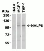 Anti-NALP6 antibody used in Western Blot (WB). GTX85157