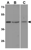Anti-YBX2 antibody used in Western Blot (WB). GTX85161