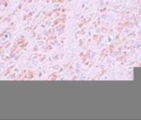 Anti-VENTX antibody used in IHC (Paraffin sections) (IHC-P). GTX85168