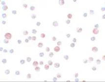 Anti-CaBP7 antibody used in Immunocytochemistry/ Immunofluorescence (ICC/IF). GTX85169