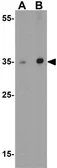 Anti-SCRN3 antibody used in Western Blot (WB). GTX85171