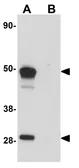 Anti-SCRN1 antibody used in Western Blot (WB). GTX85172
