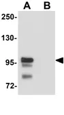 Anti-SCUBE2 antibody used in Western Blot (WB). GTX85173