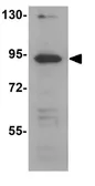 Anti-TCTN2 antibody used in Western Blot (WB). GTX85177
