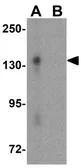 Anti-ZEB2 antibody used in Western Blot (WB). GTX85180