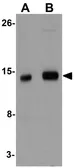 Anti-IFITM1 antibody used in Western Blot (WB). GTX85181