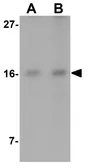 Anti-IFITM1 antibody used in Western Blot (WB). GTX85182