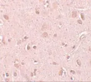 Anti-TINP1 antibody used in IHC (Paraffin sections) (IHC-P). GTX85188