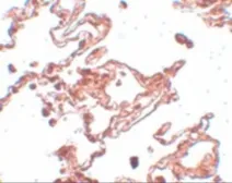 Anti-CCDC69 antibody used in IHC (Paraffin sections) (IHC-P). GTX85190