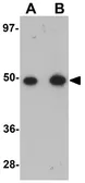 Anti-TMEM184B antibody used in Western Blot (WB). GTX85193