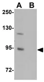Anti-ZC3H12B antibody used in Western Blot (WB). GTX85196