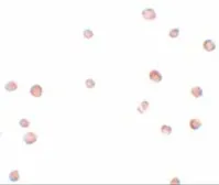 Anti-LRRC19 antibody used in Immunocytochemistry/ Immunofluorescence (ICC/IF). GTX85200