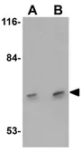 Anti-DCLK3 antibody used in Western Blot (WB). GTX85203