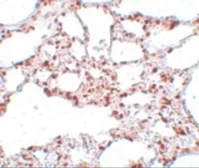 Anti-ZSCAN4 antibody used in IHC (Paraffin sections) (IHC-P). GTX85205