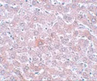Anti-RSRC1 antibody used in IHC (Paraffin sections) (IHC-P). GTX85206