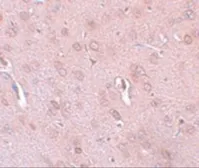 Anti-TRESK antibody used in IHC (Paraffin sections) (IHC-P). GTX85212