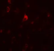 Anti-CALM antibody used in IHC (Paraffin sections) (IHC-P). GTX85213